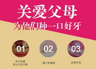 欧美显微种植牙