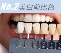 No2.美白前比色