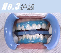 No3.护龈