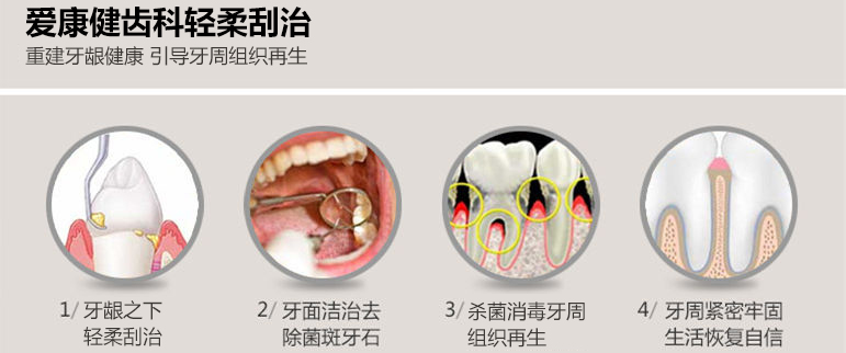 轻柔刮治