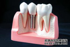 紫金县友谊医院：烤瓷牙的后遗症有哪些 