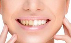 牙黄是什么原因导致的?紫金县 