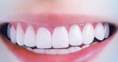 紫金县冷光美白后出现牙齿敏感是正常的 
