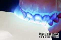 紫金县冷光牙齿美白可靠吗，有什么优势 